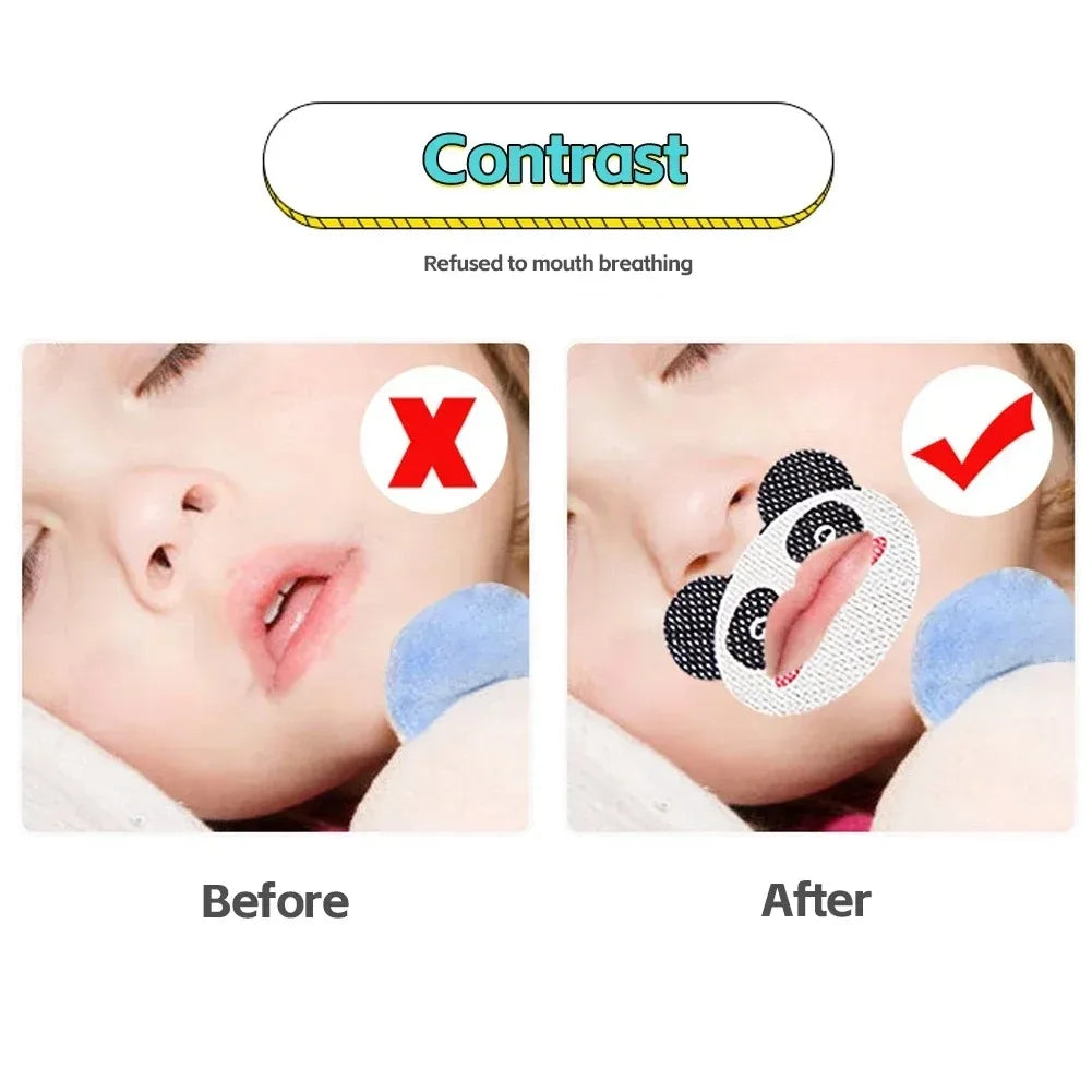 Kids Anti-Snoring Sleep Stickers – Gentle Night Breathing Support for Children